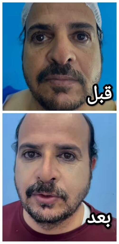 عمليات تجميل الوجه بالصور