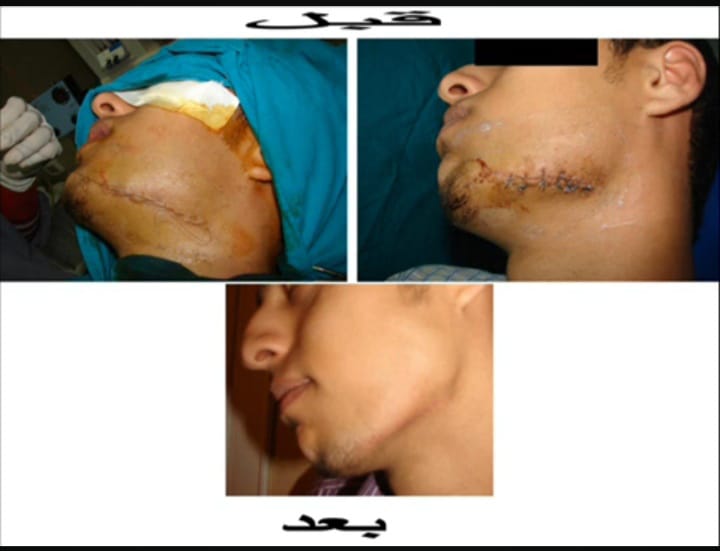 تجميل الوجه بالليزر أحسن دكتور تجميل الوجه بالليزر