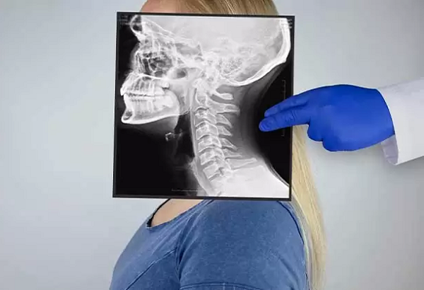 أفضل دكتور تجميل كسر عظام الوجه في قطر