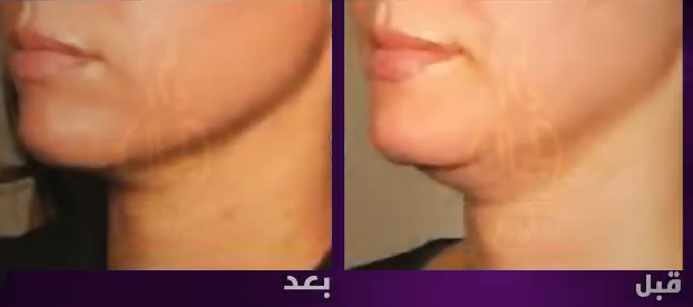 أحسن عيادة تجميل في مصر